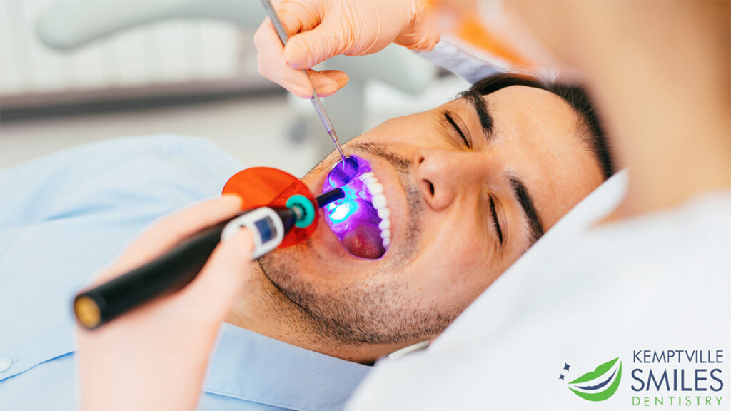 Will Dental Sealants Prevent Cavities?