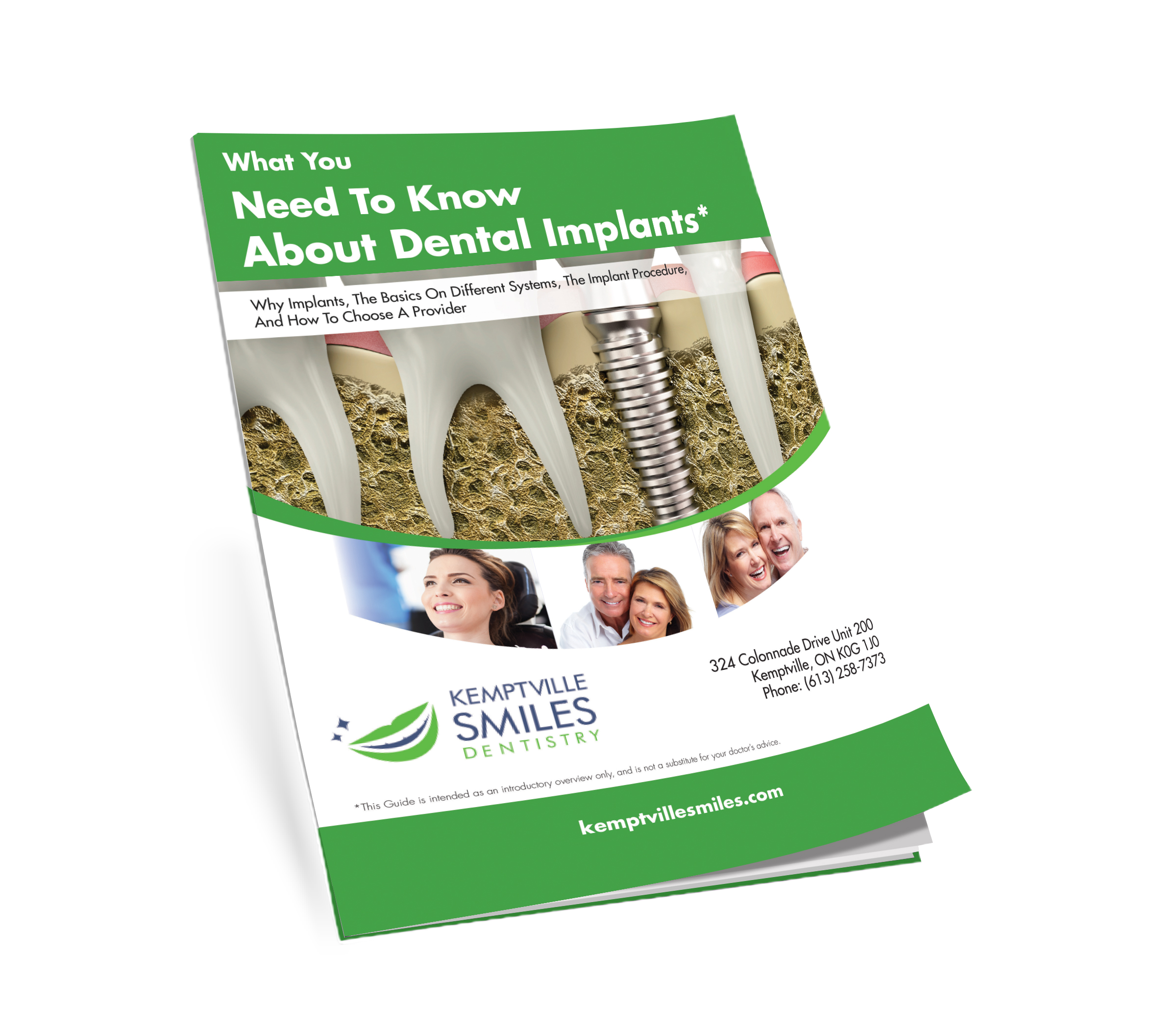 Dental Implants